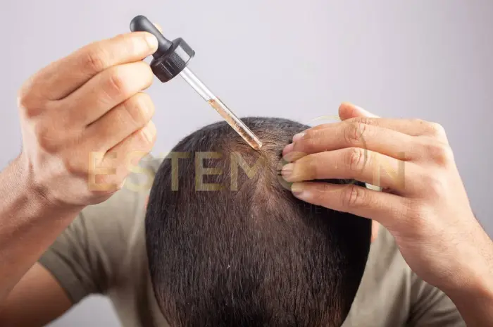 Uses, Side Effects and Benefits of Finasteride and Minoxidil