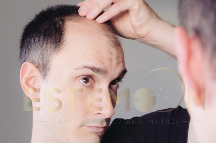 thinning hair