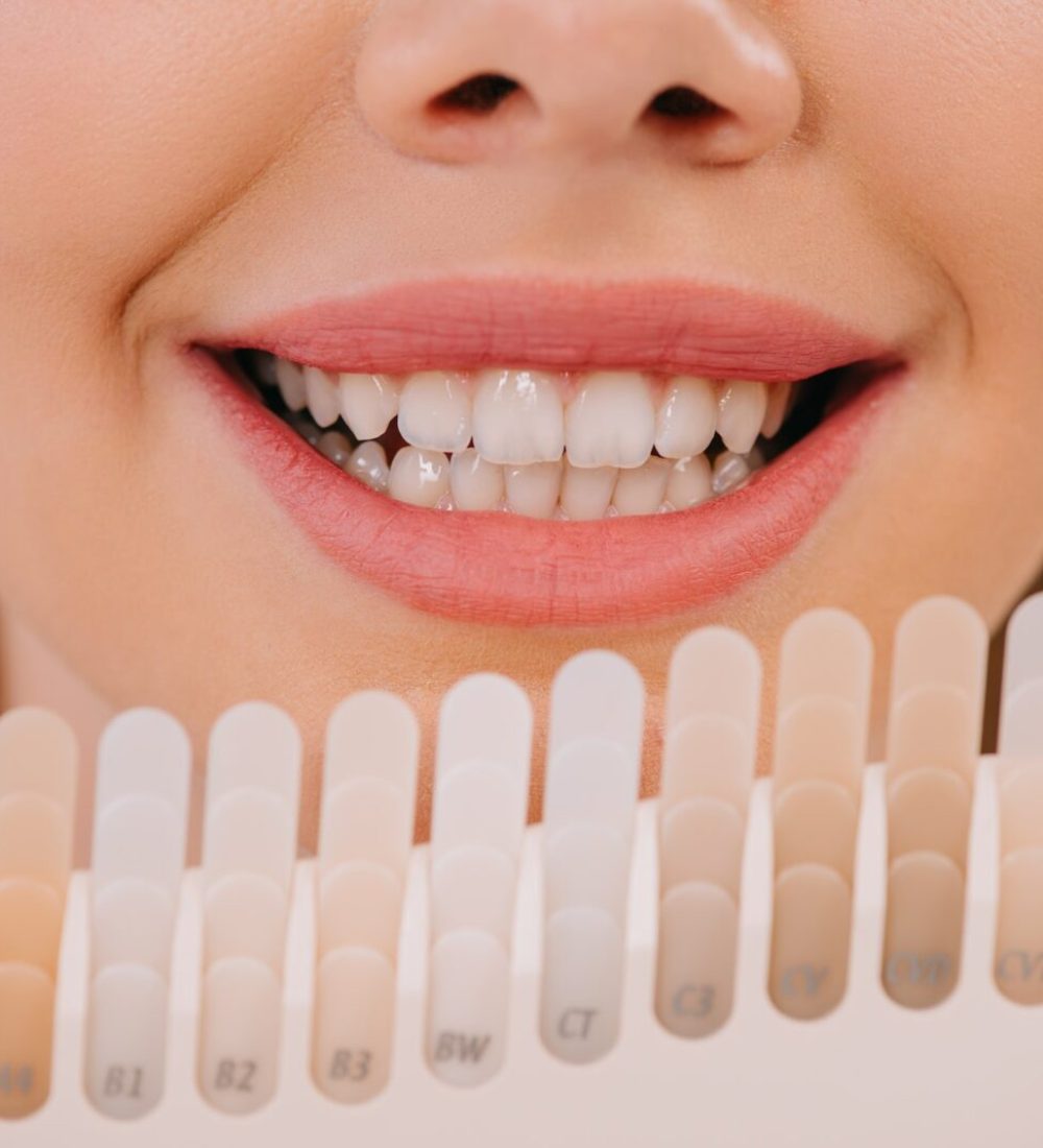 cropped view of smiling woman holding teeth color palette, teeth whitening concept